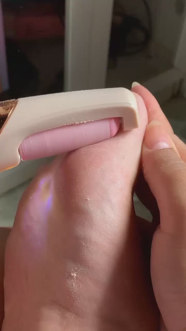 Lima Electrica Flawless®